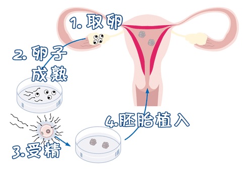 Dr. Li
